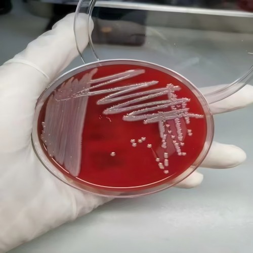 喜迎新年 | 杰瑞生物4项微生物血培养基获证