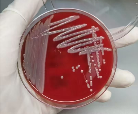 祝贺！杰瑞生物再获4项微生物血培养基备案